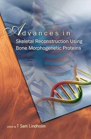 Advances in Skeletal Reconstruction Using Bone Morphogenetic Proteins book cover
