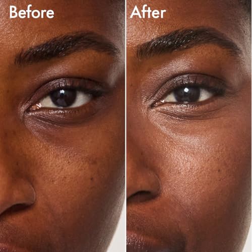 image for Catrice | Under Eye Brightener | Conceal & Brighten Dark Circles | Wit