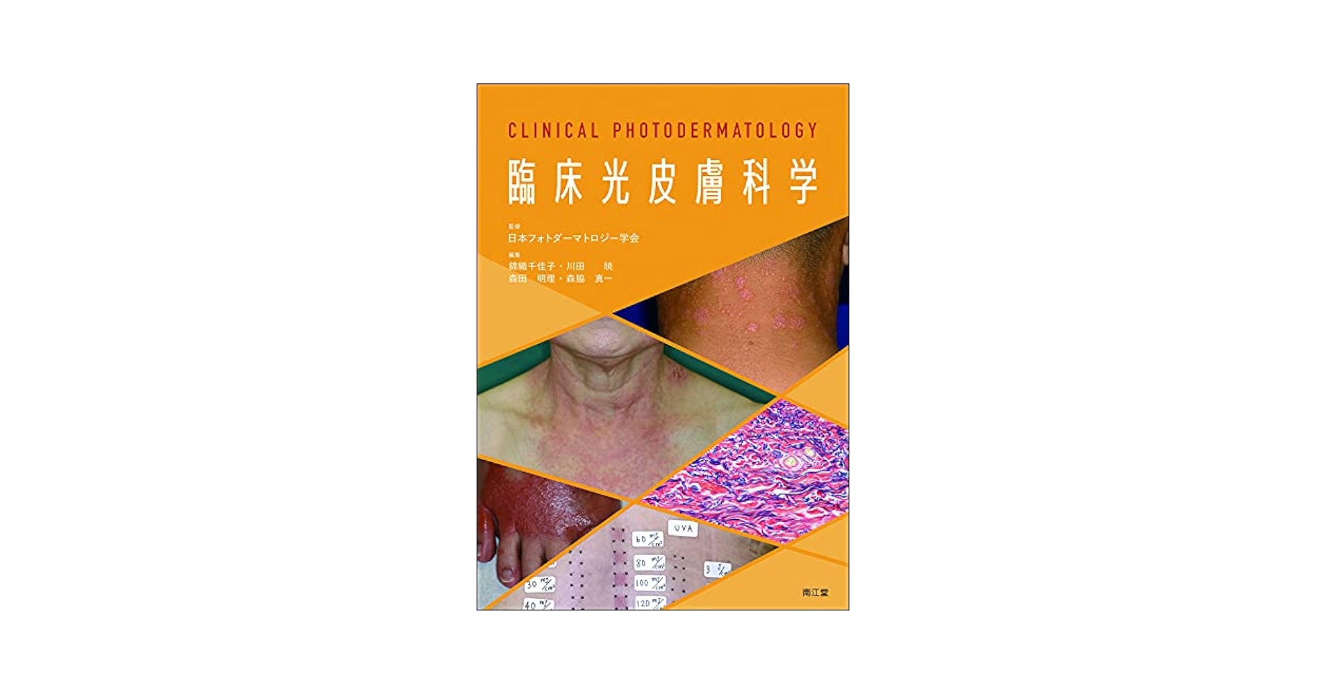 臨床光皮膚科学 Amazon.co.jp: 臨床光皮膚科学 : 日本フォトダーマトロジー学会