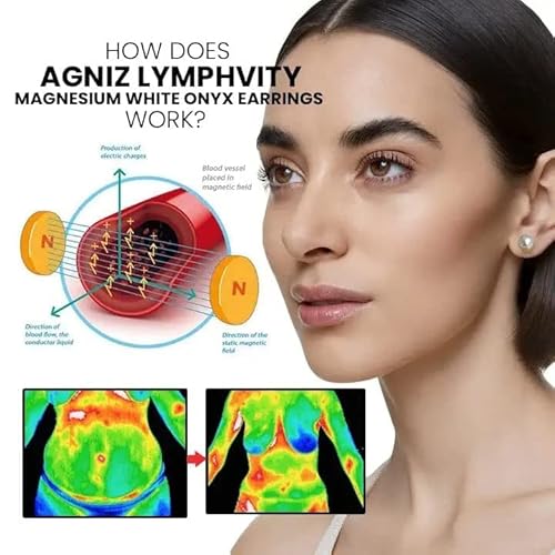Elegance Lymphvity Magnetherapy White Onyx Earrings,2023 New Lymphatic Drainage Therapeutic Magnetic Ear Ornament,Non Piercing Magnetic Acupressure Earrings For Women Men (1 Pair) #TOP1