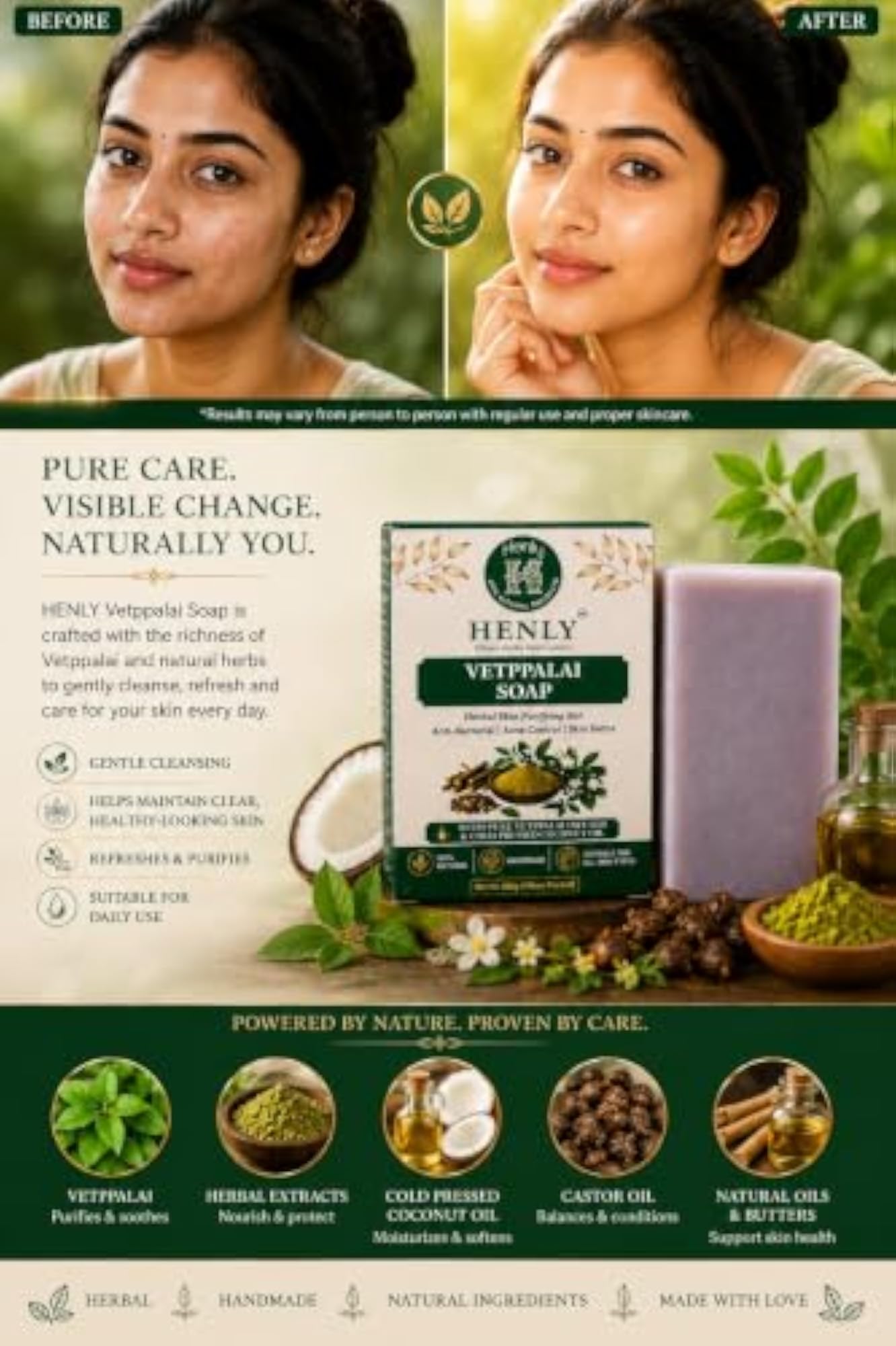 Vetpalai Herbal Handmade Skin Care Soap