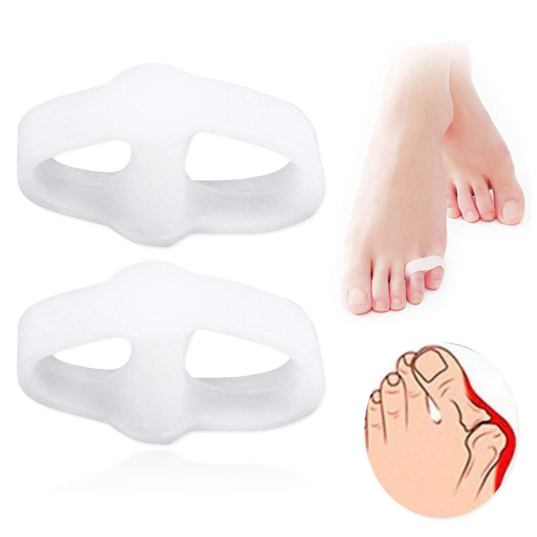 Pedimend doppio foro piccole dita – mignolo alluce valgo Protector Bunion regolatore – allevia la pressione/evitare Squeezing – per uomini e donne – cura dei piedi