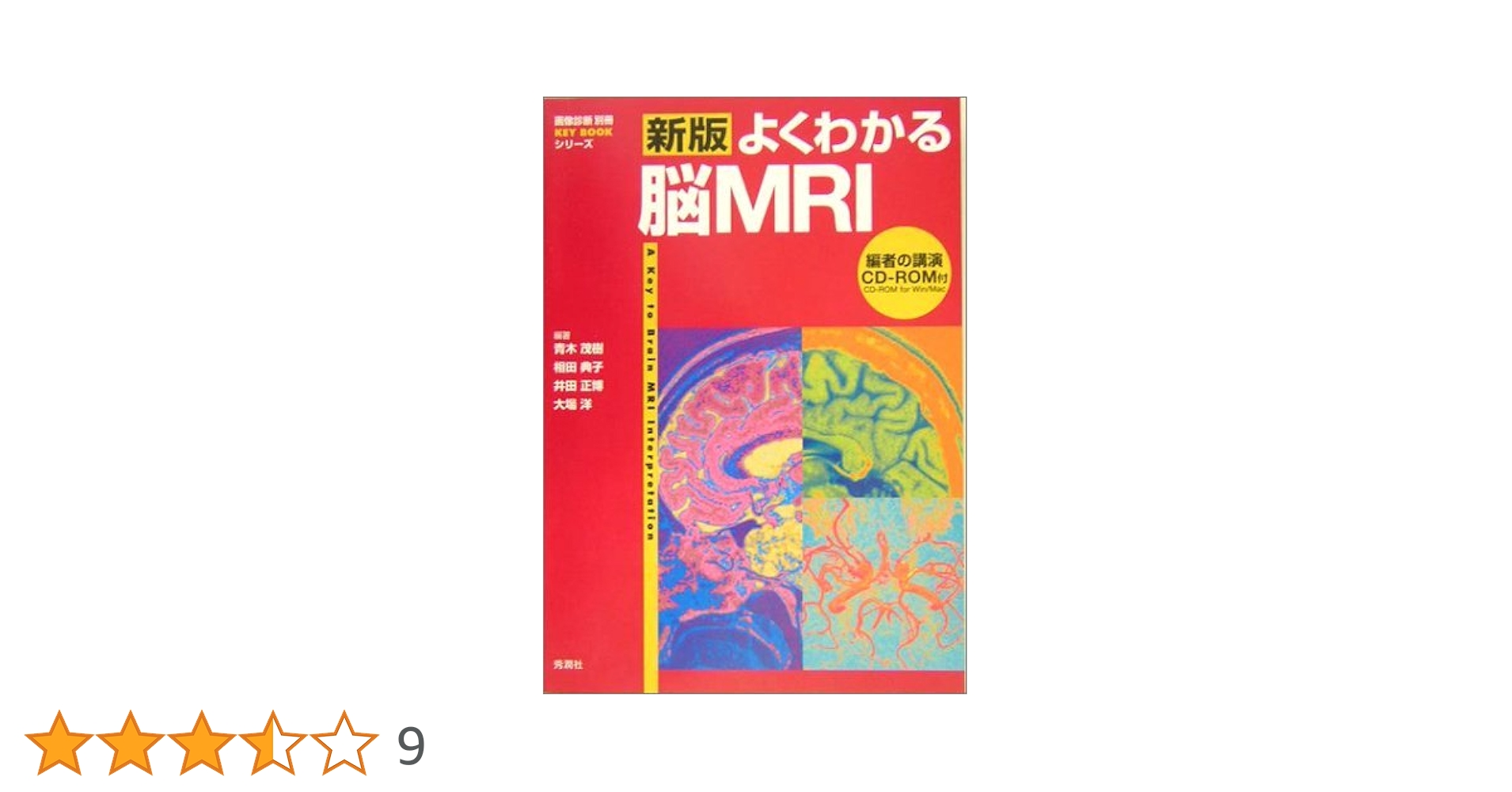 よくわかる脳MRI Amazon.co.jp: よくわかる脳MRI改訂第4版 (画像診断別冊KEYBOOK