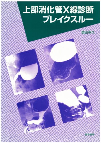 無料電子書籍 アプリ 上部消化管X線診断ブレイクスルー バイ
