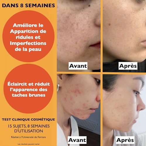 60 ml Bio Sérum Visage à la Vitamine C, Acide Hyaluronique Pur, Vit. E, B5 et Niacinamide. Anti-Rides, Anti-Taches, Anti-âge et Hydratant. Soin Visage Vegan & Cruelty Free.Testé Dermatologiquement – Image 6