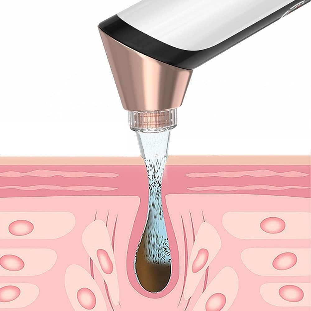 Blackhead Cleaner, Blackhead Cleaner, Blackhead Extractor Pore Cleaner, Blackhead Extractor, Deep Facial Cleansing Machine for Women and Men, 5 Replaceable Probes