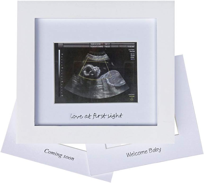 IHEIPYE Baby Sonogram Photo Frame - Ultrasound Picture Frame for Expecting Parents, Baby Showers, Gender Reveal Parties, Nursery Decor (Silver Text, White)