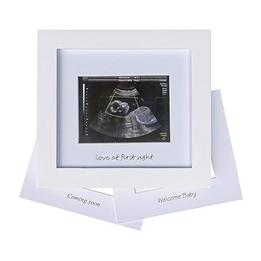 IHEIPYE Baby Sonogram Photo Frame - 1st Ultrasound Picture Frame - Idea Gift for Expecting Parents,Baby Shower, Gender Reveal Party,Baby Nursery Decor (Silver Text, White)