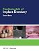 Fundamentals of Implant Dentistry
