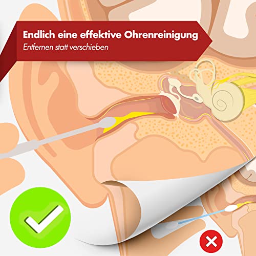 NEUMANN® Wiederverwendbares Ohrenreinigungs-Set - rostfreier Edelstahl - Handliche Aufbewahrungsbox (Schlinge, Spirale & Löffelform) Premium Ohrenschmalz-Entferner für Erwachsene [Silber Edelstahl]