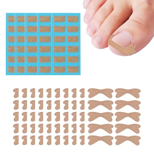 160PCS Toe Nail Remover, Toenail Correction Patch and Ingrown Toenail Correction Tool, 10 Butterfly + 5 Square Nail Correctors for Daily Nail Care and Pain Relief