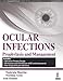Ocular Infections: Prophylaxis and Management