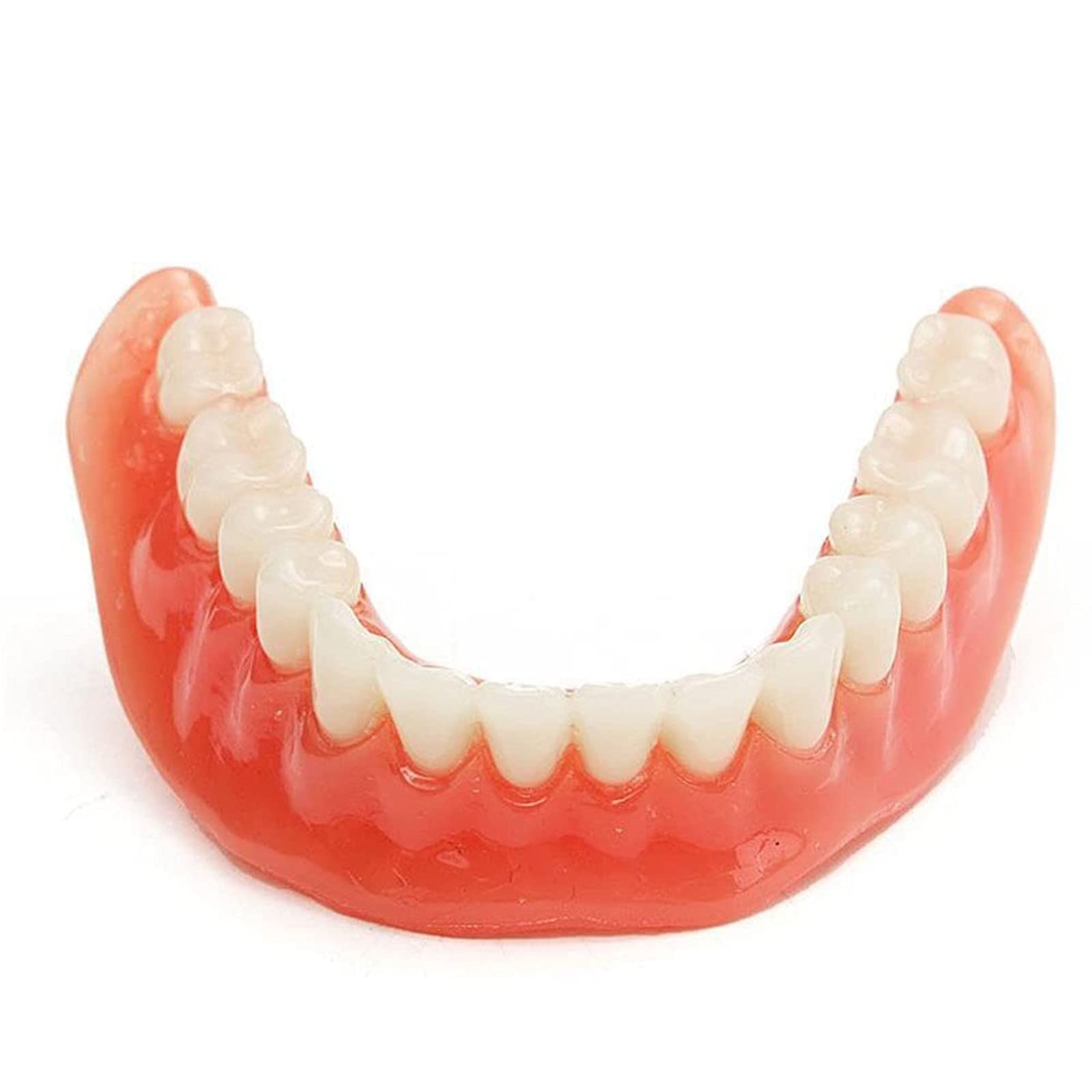 Modelo de sobredentadura Dental, modelo de dientes de enfermedad de implante, demostración de 2 implantes, para enseñar, estudiar, mostrar, comunicación con el paciente