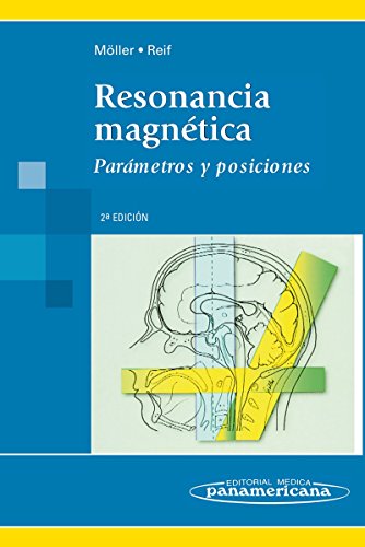 Resonancia Magnética: Parámetros y posiciones (Spanish Edition) Resonancia Magnética: Parámetros y posiciones (Spanish Edition)