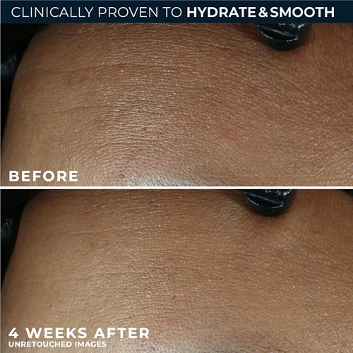 RoC Retinol Correxion Max Hydration Moisturizer