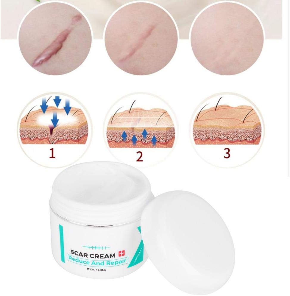 Scar Cream, Scar Serum, Stretch Marks Removal Skin Repair Cream Scar