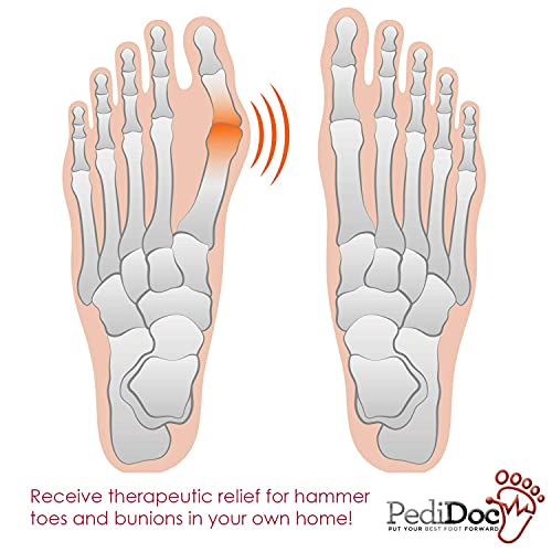 Pedidoc Bunion Corrector Bunion Toe Straightener – Bunion Relief Big Toe Strap Bunion Splint Restores Natural Alignment Of Overlapping And Crooked Toes – Big Toe Spacer And Toe Stretcher #TOP5