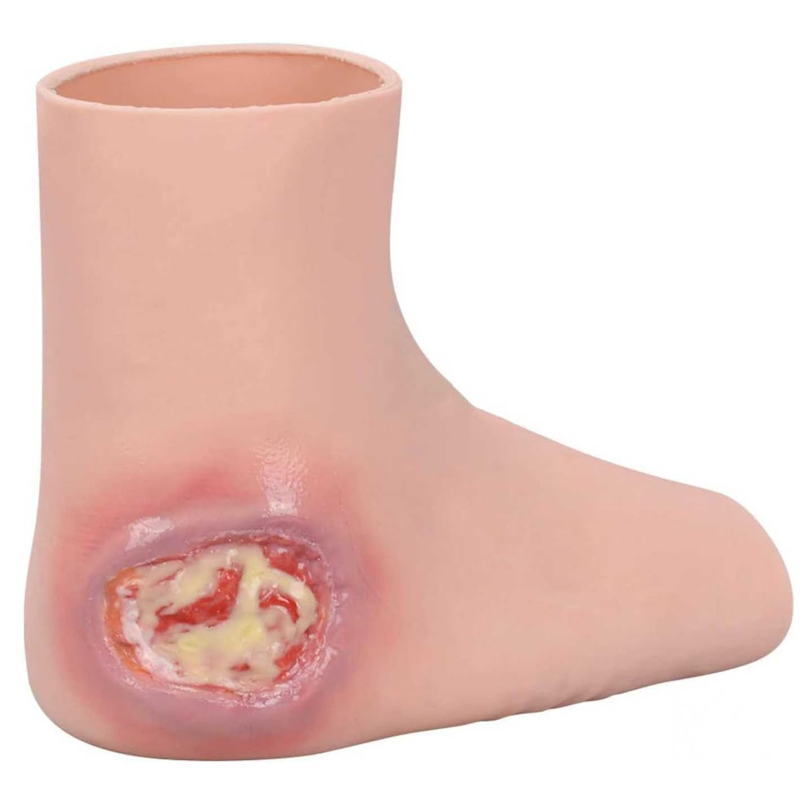 GNbow Wearable Foot Wound Model, Heel Ulcer Wound Training Sleeve, Realistic Silicone Demo for Decubitus Ulcer Care Practice and Demonstration, Teaching Practice