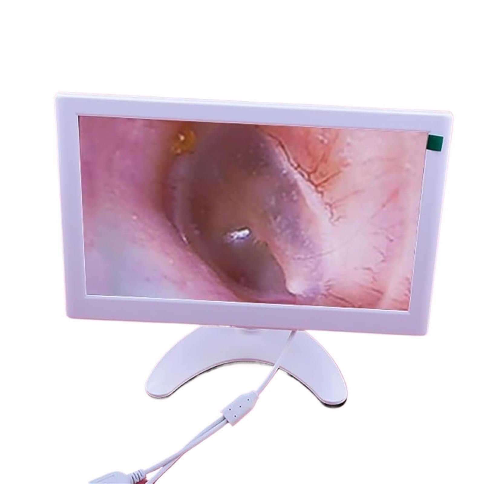 Herramienta digital de eliminación de cera for oídos, otoscopio visual HD de 3,2 mm con giroscopio y luz ajustable de 4 niveles, limpiador de oídos con cámara y pantalla for adultos