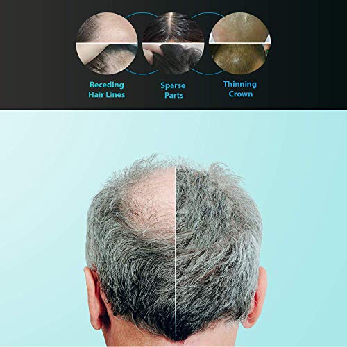 KERNELMED-Laser-Hair-Growth-Helmet-FDA-Cleared-Hair-Loss-Regrowth-Cap-Treatment-for-Men-and-Women-Uses-Laser-Comb-Hair-Loss-Products-Red-Light-Therapy