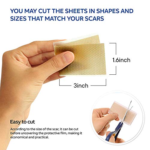 Top 10 Best acne scar patch Reviews NecoleBitchie