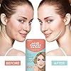 AUSLKA-160-PatchBlemish-Pimple-Patches-Zit-Stickers-Blemish-Spot-Patch-Hydrocolloid-Blemish-Dots-for-Face AUSLKA (160 Patch) Acne Pimple Patches, Zit Stickers, Blemish Spot Patch, Hydrocolloid Acne Pimple Patch for Face Zit…