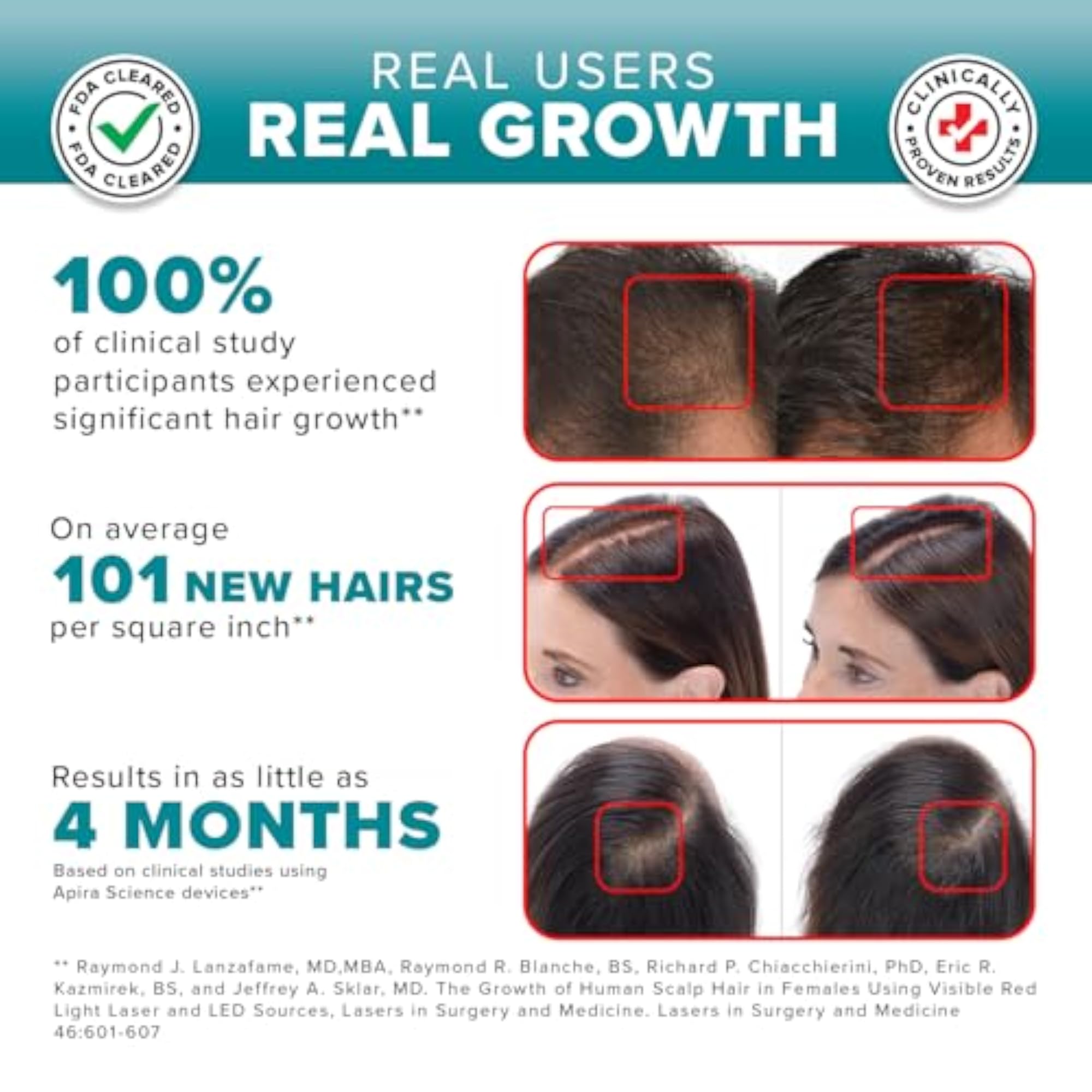 Hair Rejuvenation System Non-Surgical