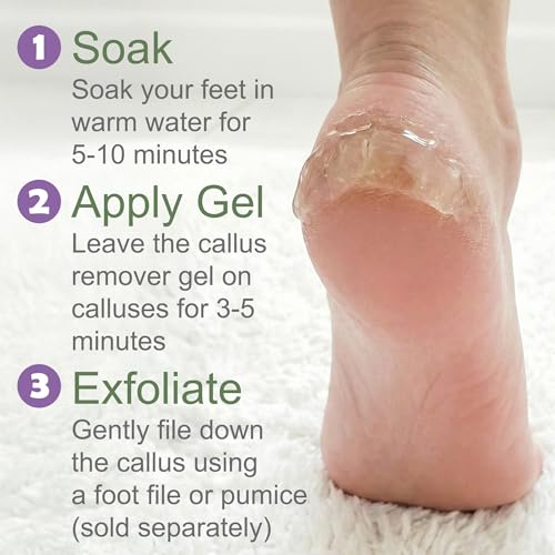 Image of Callus Remover for Feet (Extra Strength 8 oz) Foot Callus Remover Gel, Spa Foot Care, Pedicure Tools for Feet Scrubber