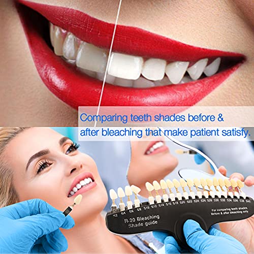 Annwah Dental Teeth Shade Guide, Professional Porcelain 3D R-20 Tooth Whitening Shade Chart With 20 Colors #TOP2