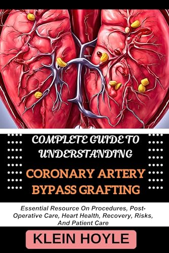 COMPLETE GUIDE TO UNDERSTANDING CORONARY ARTERY BYPASS GRAFTING: ...