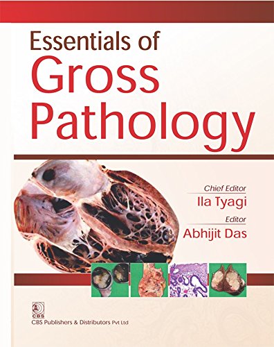 Essentials Of Gross Pathology (Pb 2017) [Paperback] TYAGI