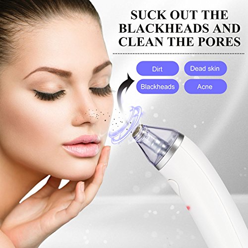 Socu Aspiratore Punti Neri, ottava generazione