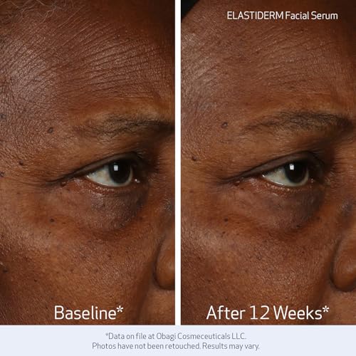 Obagi Medical Obagi ELASTIDERM Facial Serum 1oz & Eye Serum .47oz Set – Clinically Proven to Firm Skin, Target Signs of Aging & De-Puff Eyes with Caffeine & Patented Bi-Mineral Contour Complex