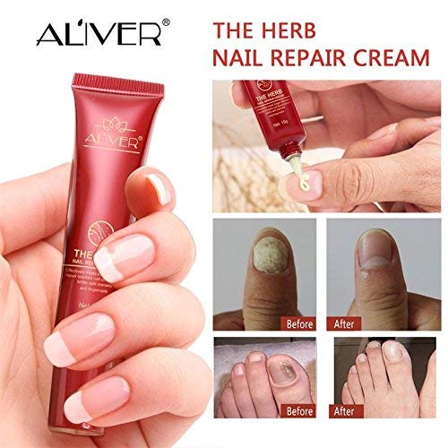 Aliver Herb Premium Fungal Nail Treatment Powerful Anti Fungal Nail