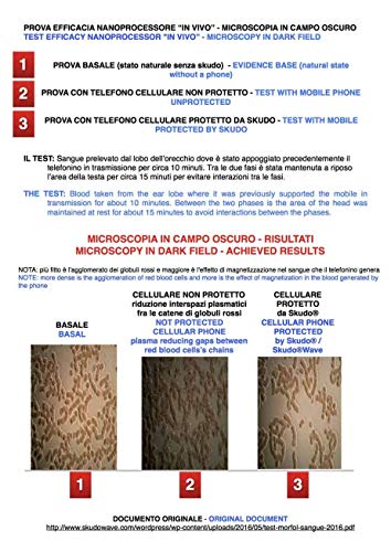 Skudowave Dispositivo di Protezione Radiazioni