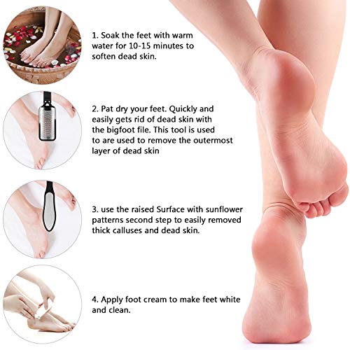 Umitive Voetvijlen voor harde huid, 8 stuks voet eelt remover set, roestvrij stalen pedicure kit voor gebarsten voeten… - Image 4