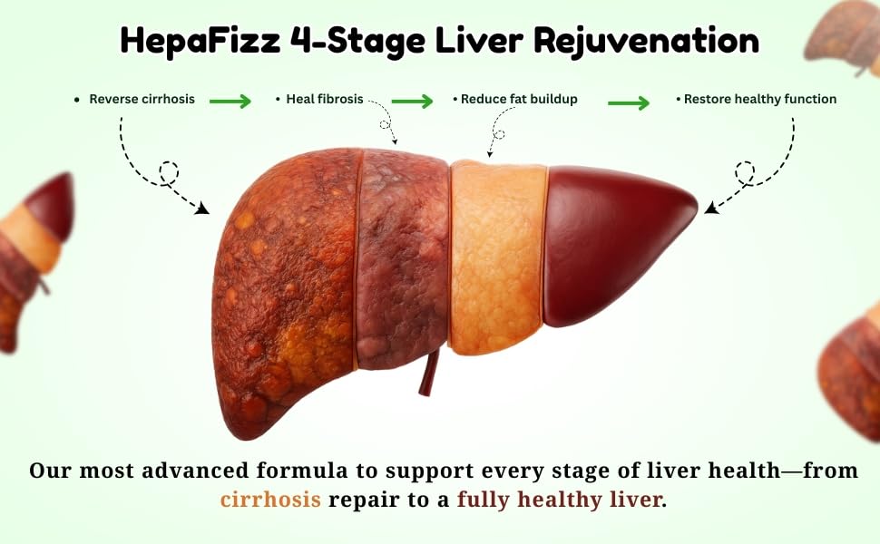 Image of HepaFizz Liver Detox Effervescent Tablets 80 Tabs Ideal For 40 Days | Silymarin 250mg Milk Thistle + Vitamin B9, B12 | Ayurvedic Liver Cleanse Supplement | Green Apple Flavour | Sugar-Free, Vegan | WHO-GMP Certified