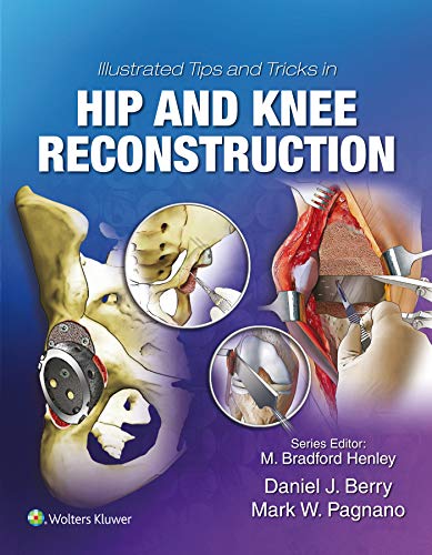 Illustrated Tips and Tricks in Hip and Knee Reconstructive and Replacement Surgery Illustrated Tips and Tricks in Hip and Knee Reconstructive and Replacement Surgery