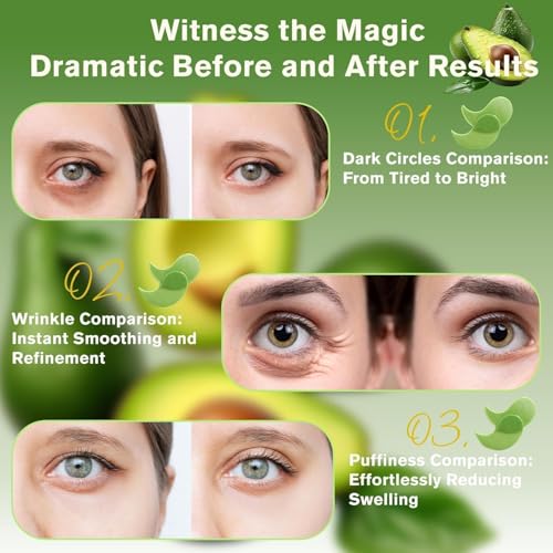 Image of cosmetic (TP- Under Eye Patches)