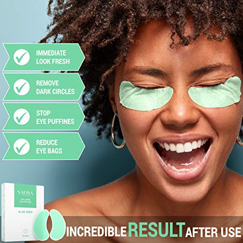 15 Pairs, Aloe Vera Under Eye Patches, Puffy Eyes & Dark Circles ...