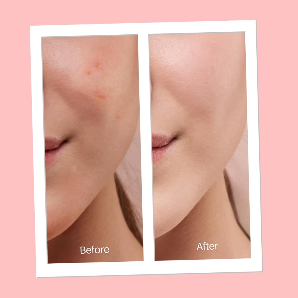 Serious Skincare Continuously Clear DRY-LO Exfoliating Solution 1 Fl. Oz. - Image 4