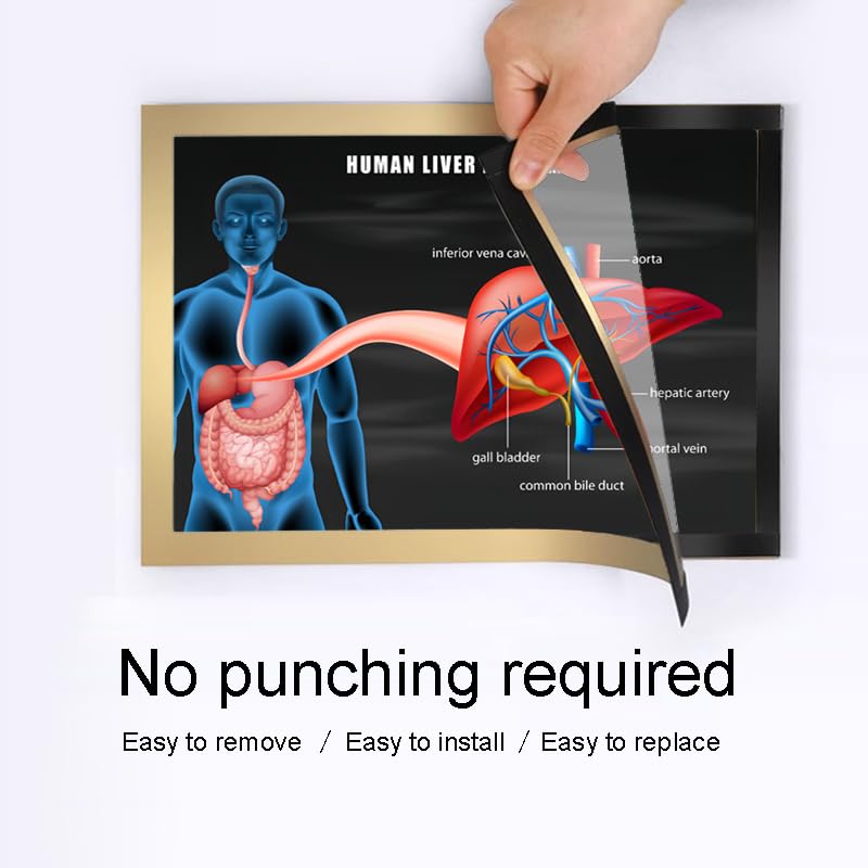 Image of Taanfu Body Educational Learning Anatomy Posters ，Liver Anatomy Art Liver Anatomy Villi Anatomy Art Poster Digestive System Organs Illustration Small Intestine Physiology Anatomy Wall Art Villi