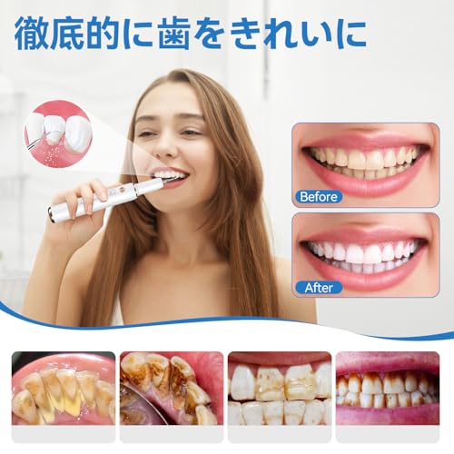 BESTEK 超音波歯クリーナー BTT4 の商品画像 2