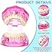 Outus Disease Teeth Model Dental Implant Teeth Model with Removable Tooth Dentist Standard Tooth Pathological Demonstration for Christmas Education Dental Supplies(Pink,1 Pcs)