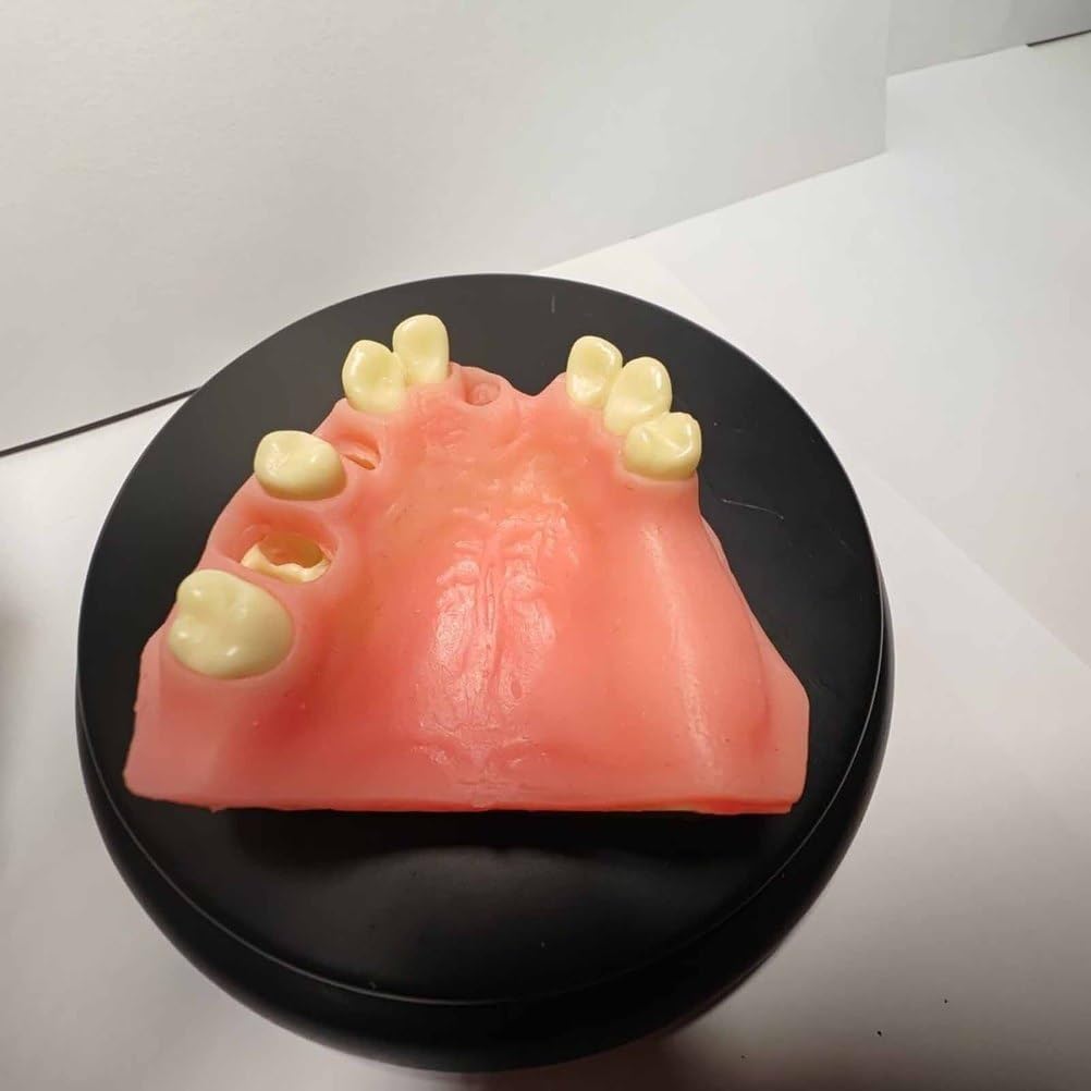 Modèle d'Implant Dentaire Modèle d'Implant Dentaire pour Formation, Enseignement, Démonstration et Étude