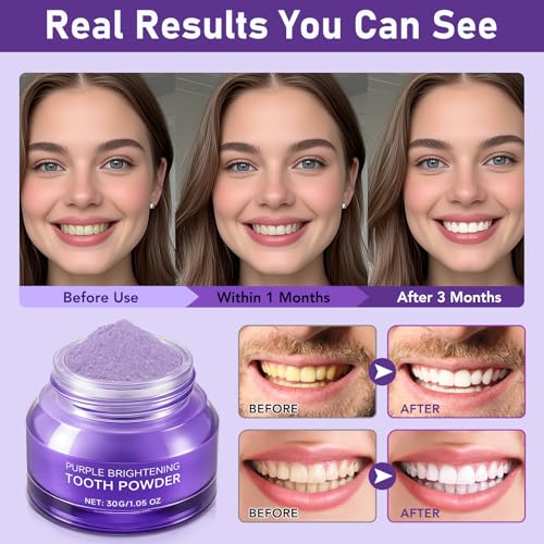 Image of Teeth Whitening Powder - Toothpaste Whitening Booster Powder, No Sensitivity, Removes Stains for Coffee, Tea, Food, Wine, and Tobacco Stains
