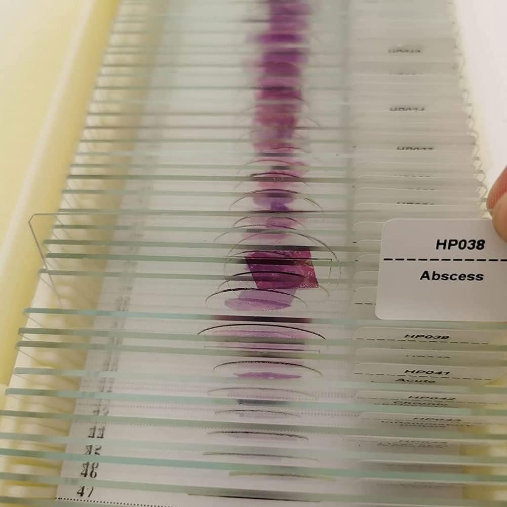 KEULEN Vetrini per Istopatologia Umana, Vetrini per Microscopio con Colorazione Strutturale di Cellule He Umane, Tintura Uniforme, Immagini Chiare, Set per Sezionamento di Tessuti Patologici Umani