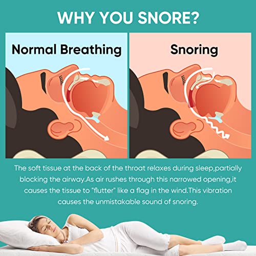 Anti Snoring Device Mouthpiece, Professional Anti-Snoring Mouth Guard, Comfortabl&Adjustable Snore Mouthpiece For Reducing Snoring, Snoring Solution For Men/Women #TOP2