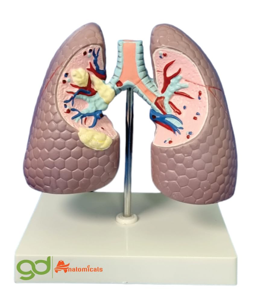 GD ANATOMICALS® "Lung Model - Educational Tool for Medical Study - Detailed Human Lung Model for Medical and Science Demonstrations" (B0CG32HZJ6) Amazon Price History, Amazon Price Tracker