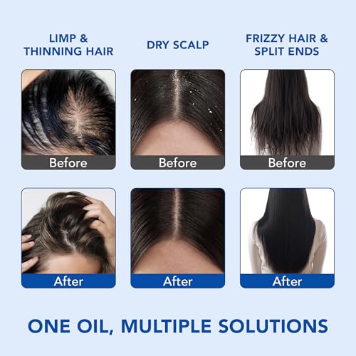 Image of Botanic Hearth Rosemary Essential Oil for Hair Growth, Hair Fall Control and Nourishment, | Clinically Tested & 100% Pure, Natural, | 30ml